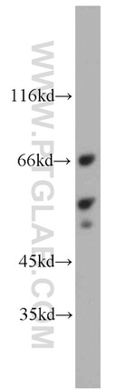 LYN Antibody in Western Blot (WB)