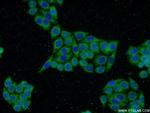 LYN Antibody in Immunocytochemistry (ICC/IF)