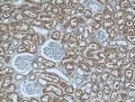 LYN Antibody in Immunohistochemistry (Paraffin) (IHC (P))