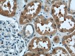 LYN Antibody in Immunohistochemistry (Paraffin) (IHC (P))