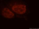 importin alpha 5 Antibody in Immunocytochemistry (ICC/IF)