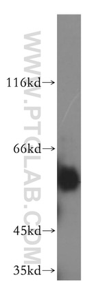 importin alpha 5 Antibody in Western Blot (WB)