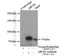 ABCD1 Antibody in Immunoprecipitation (IP)