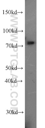 ABCD1 Antibody in Western Blot (WB)