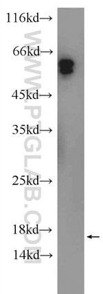 HYAL4 Antibody in Western Blot (WB)