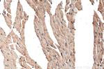 HRC Antibody in Immunohistochemistry (Paraffin) (IHC (P))