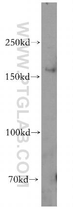 HRC Antibody in Western Blot (WB)