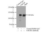 UBE4B Antibody in Immunoprecipitation (IP)