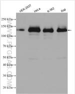 UBE4B Antibody in Western Blot (WB)