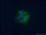 CPLX2 Antibody in Immunocytochemistry (ICC/IF)