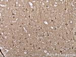 CPLX2 Antibody in Immunohistochemistry (Paraffin) (IHC (P))