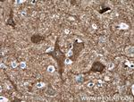 CPLX2 Antibody in Immunohistochemistry (Paraffin) (IHC (P))