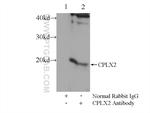 CPLX2 Antibody in Immunoprecipitation (IP)