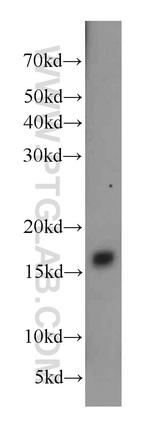 CPLX2 Antibody in Western Blot (WB)