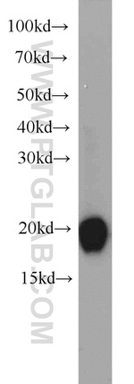 CPLX2 Antibody in Western Blot (WB)