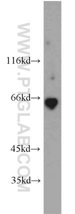 Podocalyxin Antibody in Western Blot (WB)