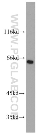 Podocalyxin Antibody in Western Blot (WB)