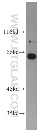 Podocalyxin Antibody in Western Blot (WB)