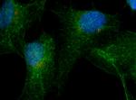 RAB9B Antibody in Immunocytochemistry (ICC/IF)