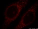 RAB9B Antibody in Immunocytochemistry (ICC/IF)