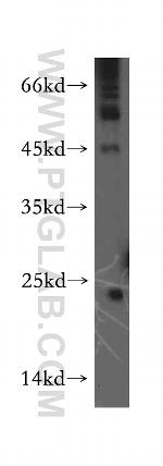 RAB9B Antibody in Western Blot (WB)