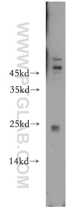 RAB9B Antibody in Western Blot (WB)