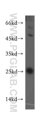 RAB9B Antibody in Western Blot (WB)