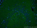 Piccolo Antibody in Immunohistochemistry (PFA fixed) (IHC (PFA))