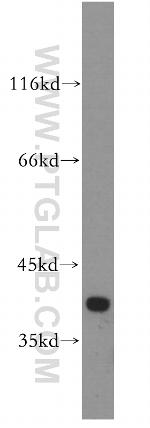 FAM118B Antibody in Western Blot (WB)