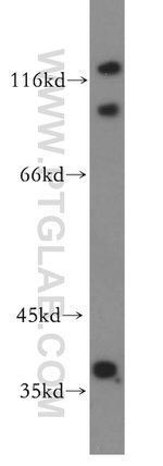 FAM118B Antibody in Western Blot (WB)