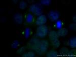 MMP13 Antibody in Immunocytochemistry (ICC/IF)