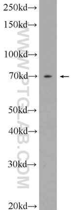 MMP13 Antibody in Western Blot (WB)