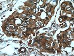 AMPK alpha 2 Antibody in Immunohistochemistry (Paraffin) (IHC (P))