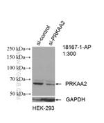 AMPK alpha 2 Antibody in Western Blot (WB)