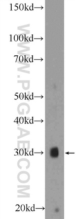 FGF5 Antibody in Western Blot (WB)