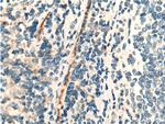 CLEC4G Antibody in Immunohistochemistry (Paraffin) (IHC (P))