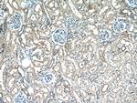 Frizzled 10 Antibody in Immunohistochemistry (Paraffin) (IHC (P))