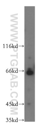 Frizzled 10 Antibody in Western Blot (WB)