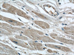 AIP/ARA9 Antibody in Immunohistochemistry (Paraffin) (IHC (P))