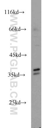 AIP/ARA9 Antibody in Western Blot (WB)