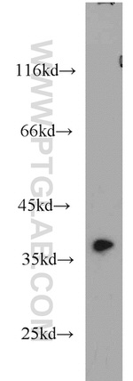 AIP/ARA9 Antibody in Western Blot (WB)