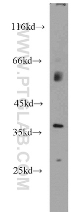 AIP/ARA9 Antibody in Western Blot (WB)