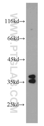 AIP/ARA9 Antibody in Western Blot (WB)