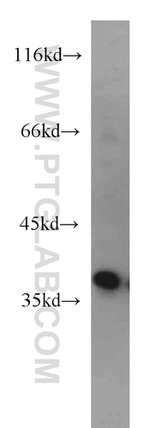 AIP/ARA9 Antibody in Western Blot (WB)