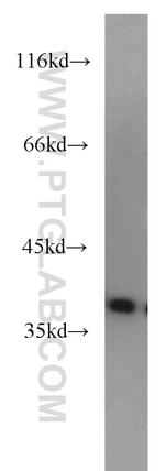 AIP/ARA9 Antibody in Western Blot (WB)