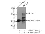 ABCD2 Antibody in Immunoprecipitation (IP)