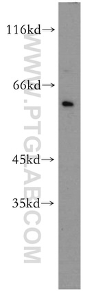 NOP56 Antibody in Western Blot (WB)