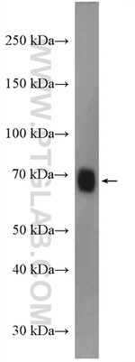 NOP56 Antibody in Western Blot (WB)