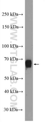 NOP56 Antibody in Western Blot (WB)