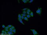 FUT7 Antibody in Immunocytochemistry (ICC/IF)